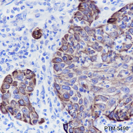 Anti-Keratin LMW Rabbit mAb