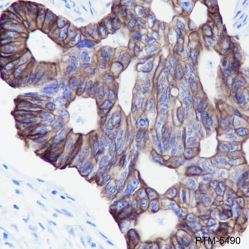 Anti-Keratin LMW Rabbit mAb