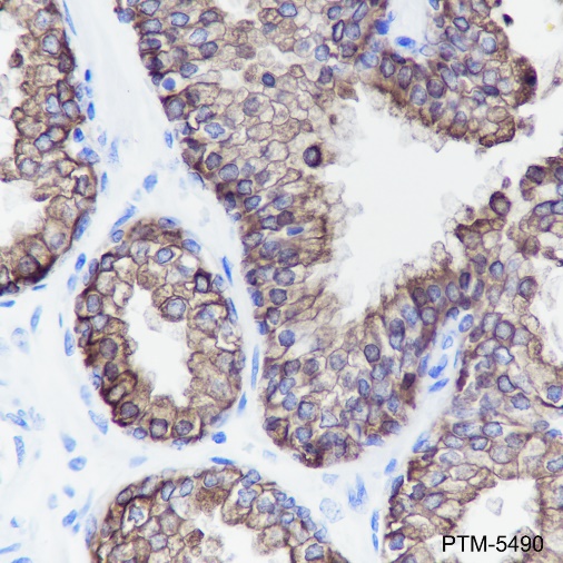Anti-Keratin LMW Rabbit mAb