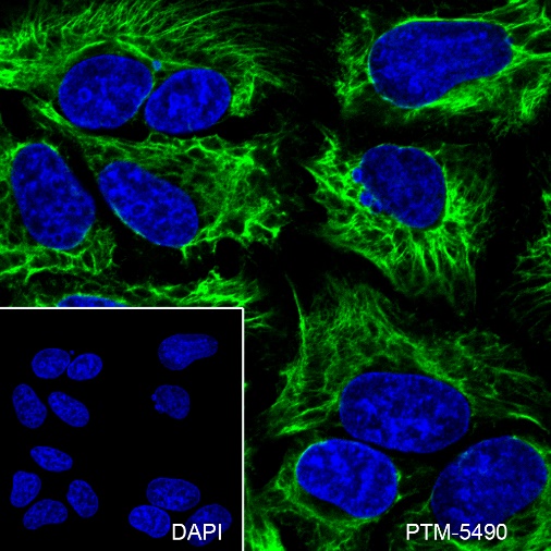 Anti-Keratin LMW Rabbit mAb