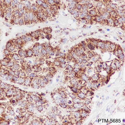 Anti-HSP60 Rabbit mAb