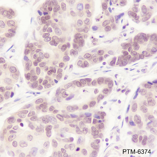 Anti-CSNK2A1 Rabbit mAb