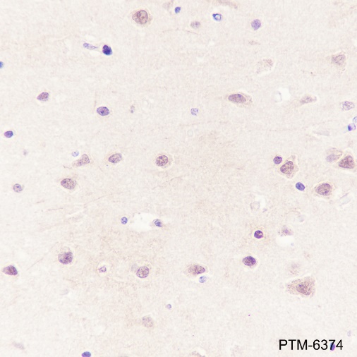 Anti-CSNK2A1 Rabbit mAb
