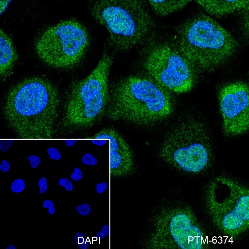 Anti-CSNK2A1 Rabbit mAb