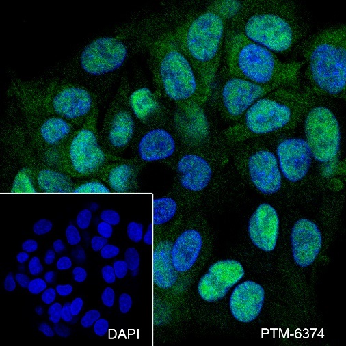 Anti-CSNK2A1 Rabbit mAb