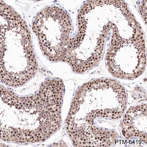 Anti-Rad51 Rabbit mAb