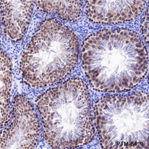 Anti-Rad51 Rabbit mAb
