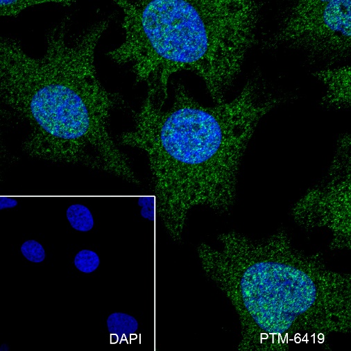 Anti-Rad51 Rabbit mAb