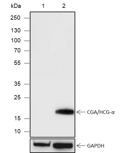 Anti-CGA / hCG alpha Rabbit pAb