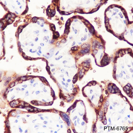 Anti-CGA / hCG alpha Rabbit pAb