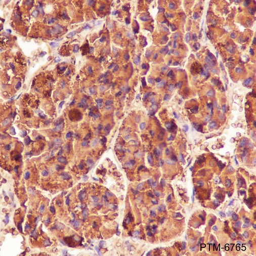Anti-CGA / hCG alpha Rabbit pAb