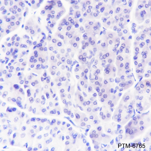 Anti-CGA / hCG alpha Rabbit pAb