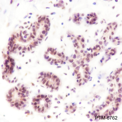 Anti-CHD4 Rabbit pAb