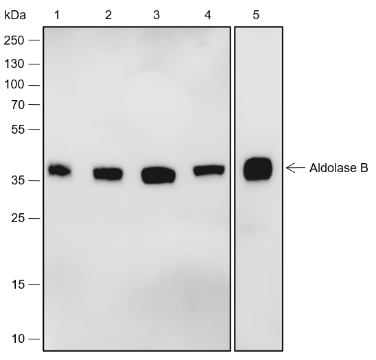 Anti-Aldolase B Rabbit pAb