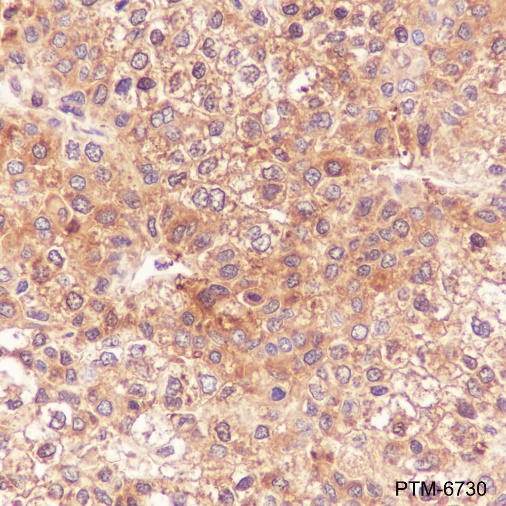 Anti-Aldolase B Rabbit pAb