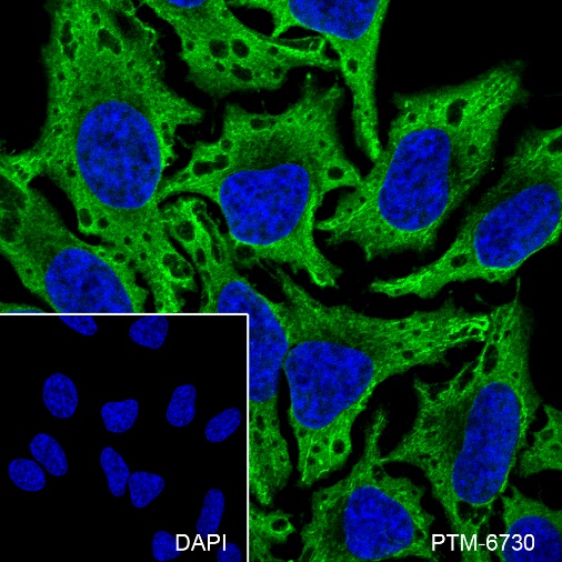 Anti-Aldolase B Rabbit pAb