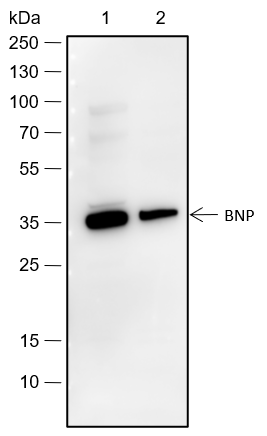 Anti-BNP Rabbit pAb