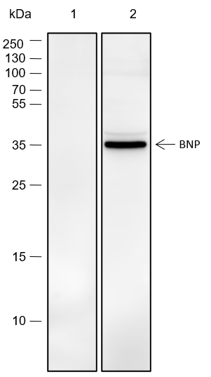 Anti-BNP Rabbit pAb