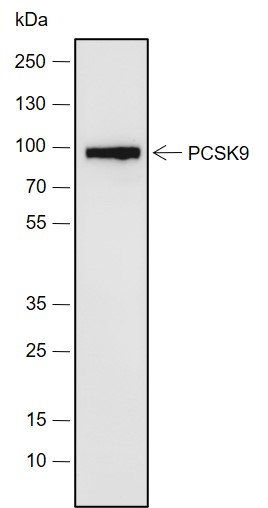 Anti-PCSK9 Rabbit mAb