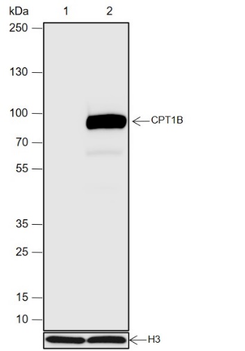 Anti-CPT1B Rabbit mAb