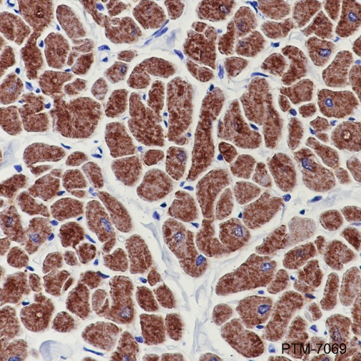 Anti-CPT1B Rabbit mAb