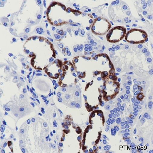 Anti-CPT1B Rabbit mAb
