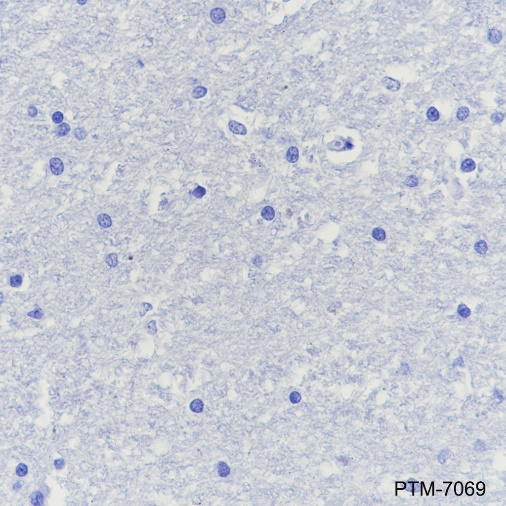 Anti-CPT1B Rabbit mAb