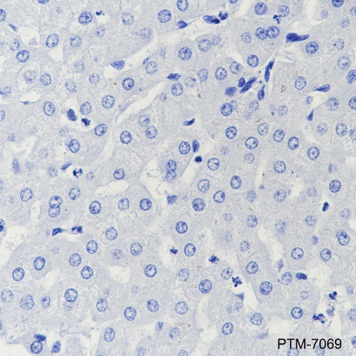 Anti-CPT1B Rabbit mAb