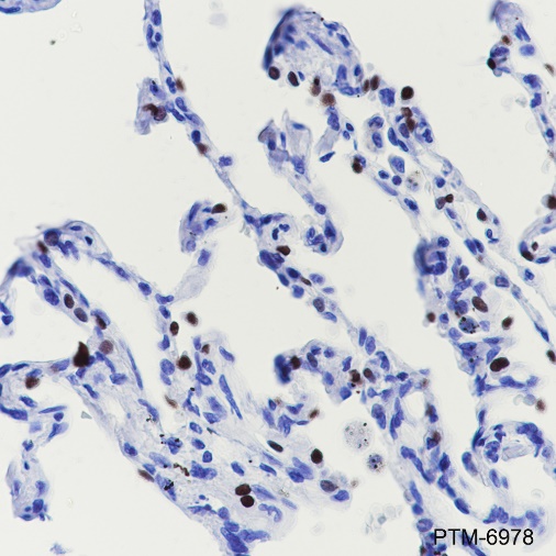 Anti-TTF1 Rabbit mAb