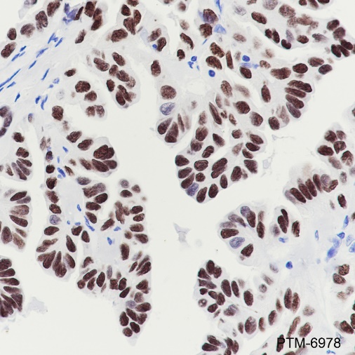 Anti-TTF1 Rabbit mAb