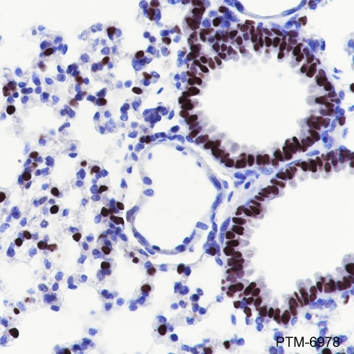 Anti-TTF1 Rabbit mAb