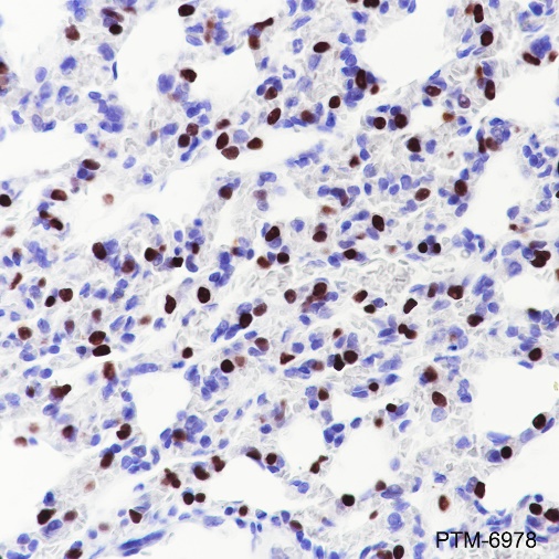 Anti-TTF1 Rabbit mAb