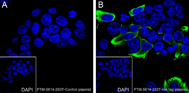 Anti-His-Tag Rabbit mAb