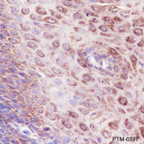 Anti-IL-1RA Rabbit mAb