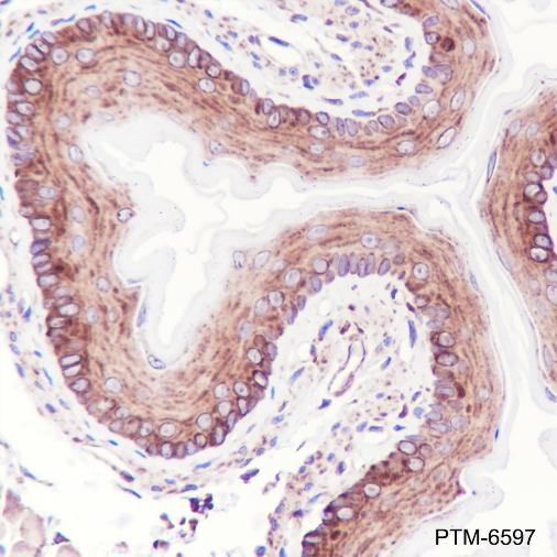 Anti-IL-1RA Rabbit mAb