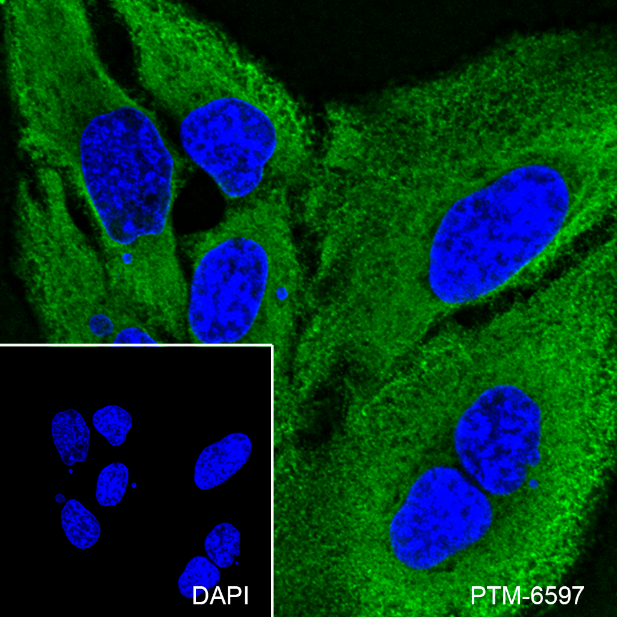 Anti-IL-1RA Rabbit mAb