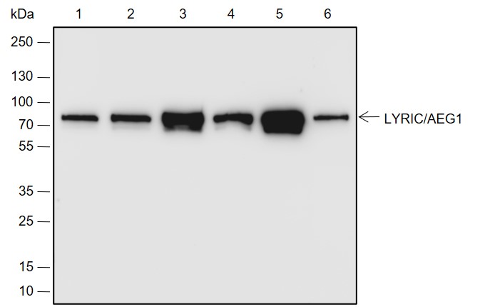 Anti-LYRIC/AEG1 Rabbit mAb