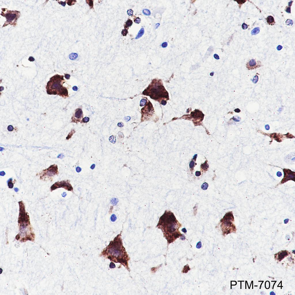 Anti-LYRIC/AEG1 Rabbit mAb