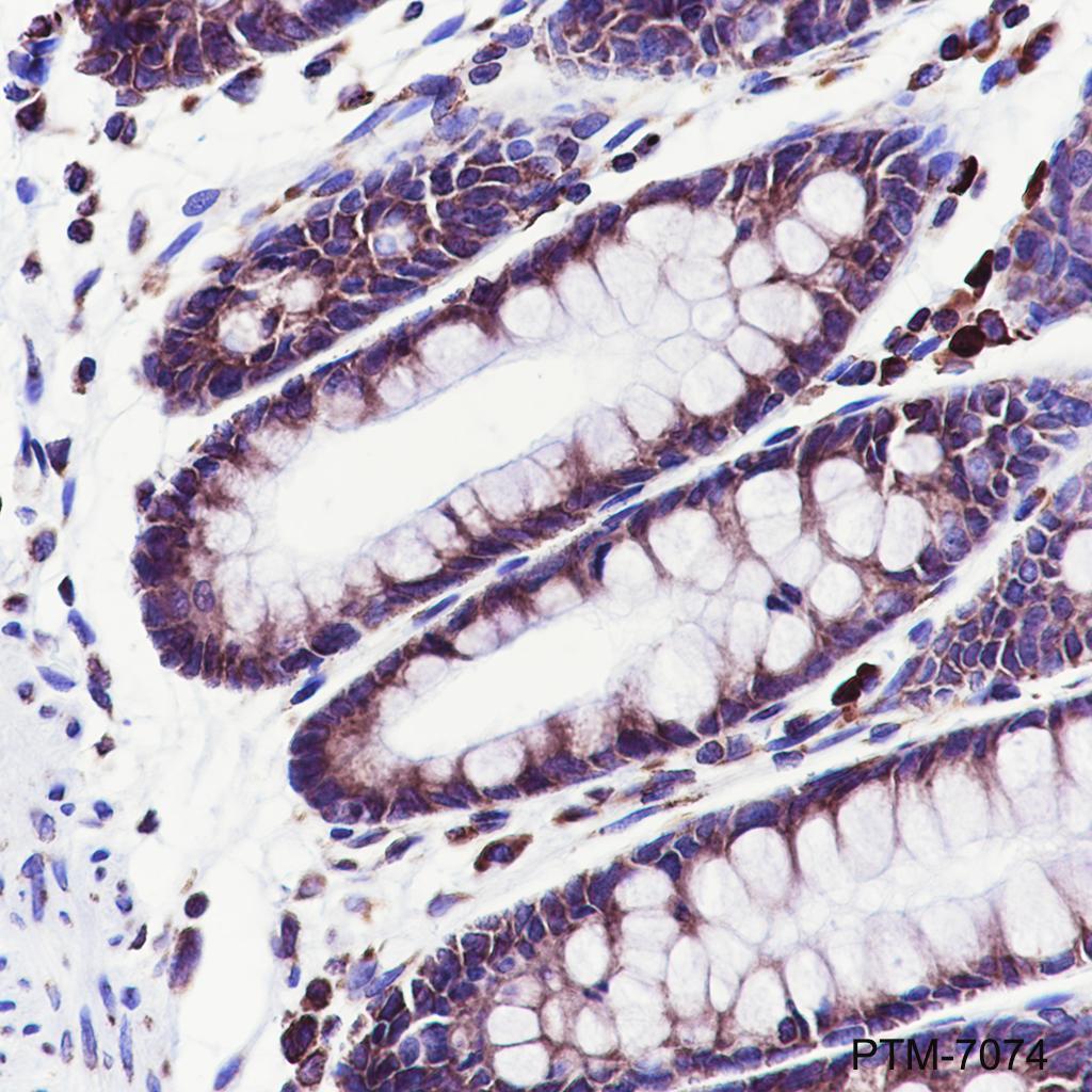 Anti-LYRIC/AEG1 Rabbit mAb