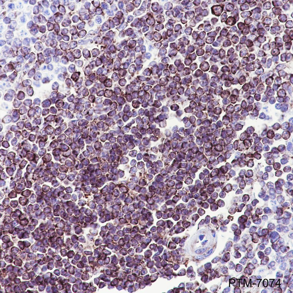 Anti-LYRIC/AEG1 Rabbit mAb