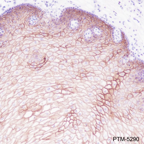 Anti-LYPD3 Rabbit mAb