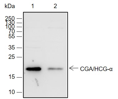 Anti-CGA / hCG alpha Rabbit mAb