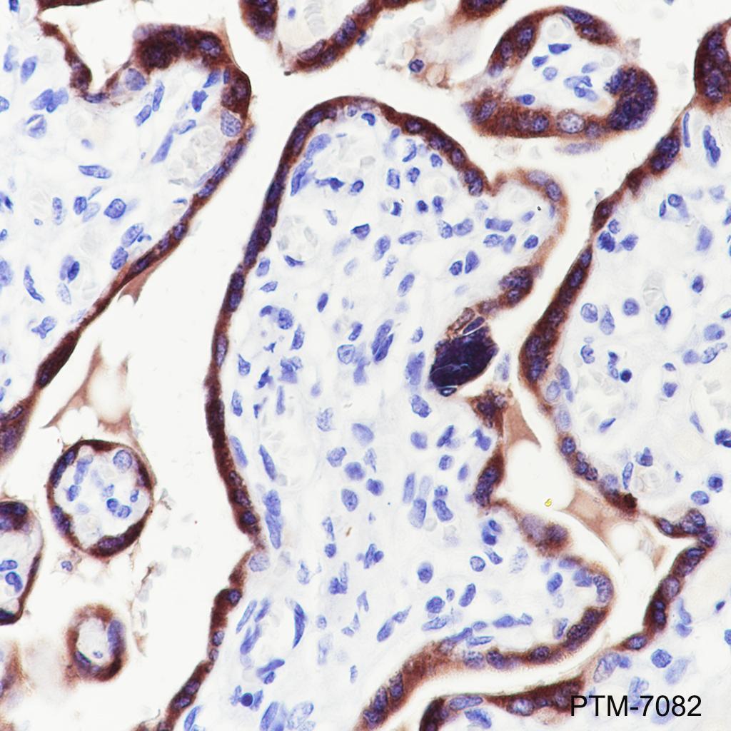 Anti-CGA / hCG alpha Rabbit mAb