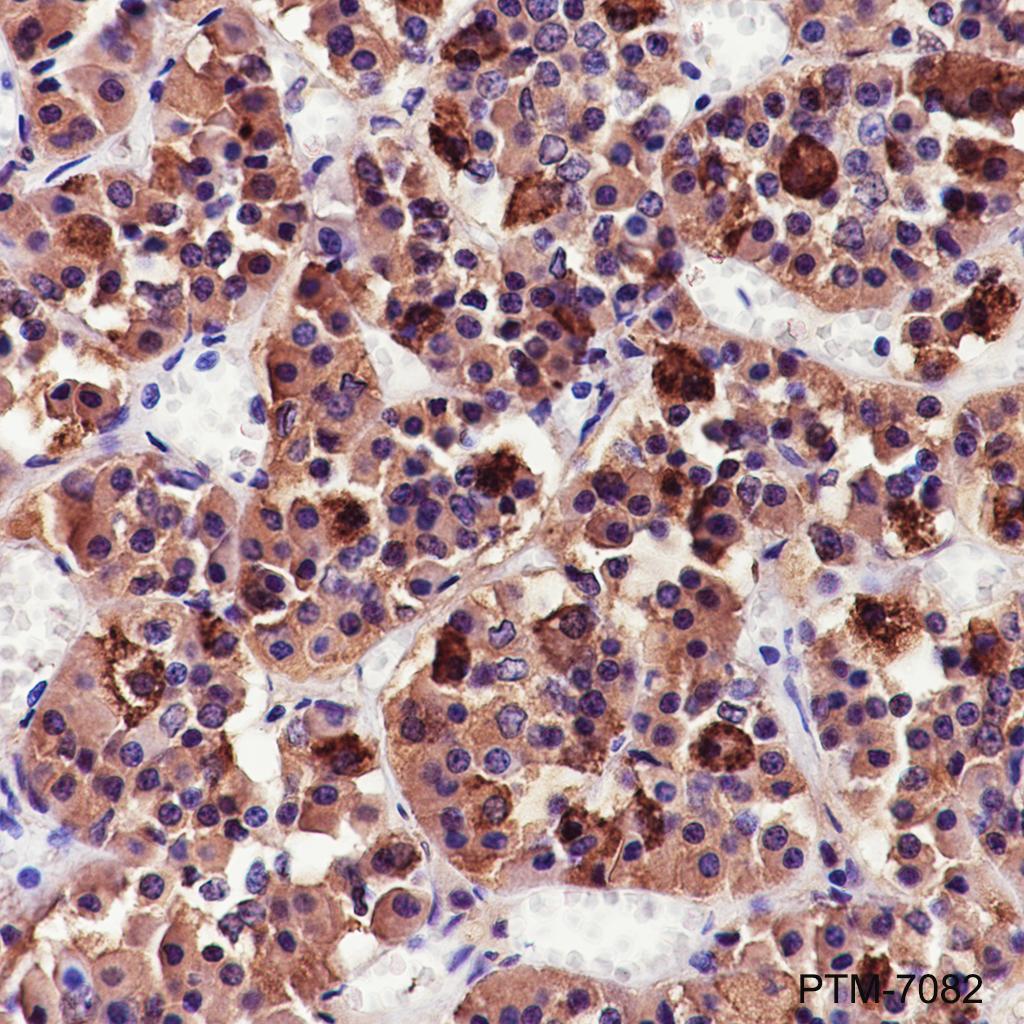 Anti-CGA / hCG alpha Rabbit mAb