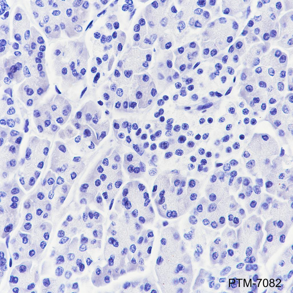 Anti-CGA / hCG alpha Rabbit mAb