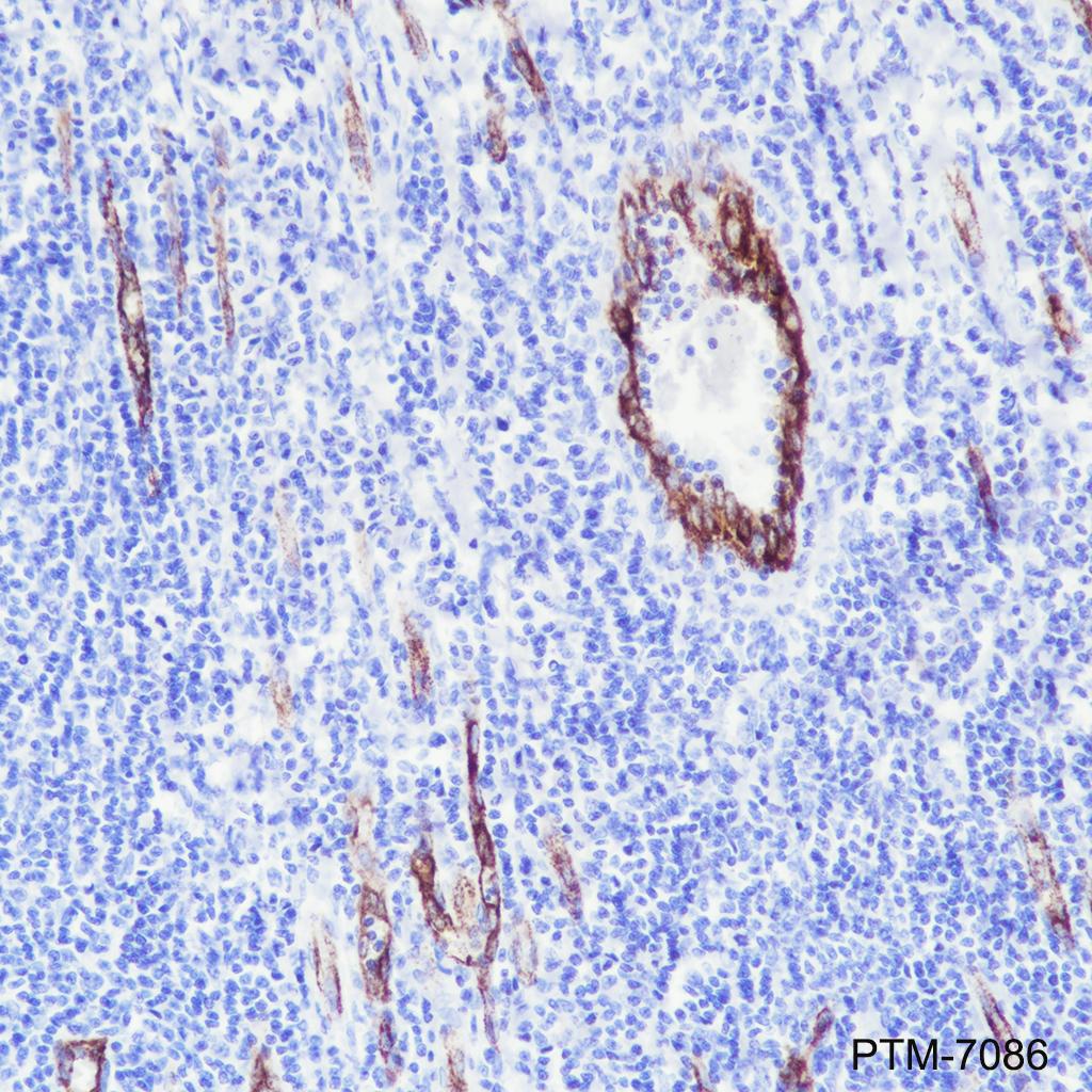 Anti-Von Willebrand Factor Rabbit mAb