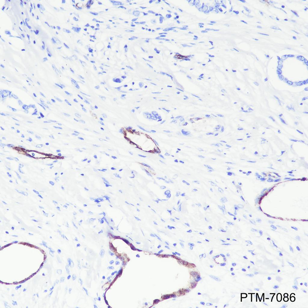 Anti-Von Willebrand Factor Rabbit mAb