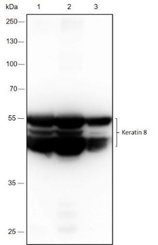 Anti-Keratin 8 Rabbit mAb