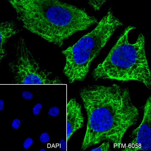 Anti-Keratin 8 Rabbit mAb