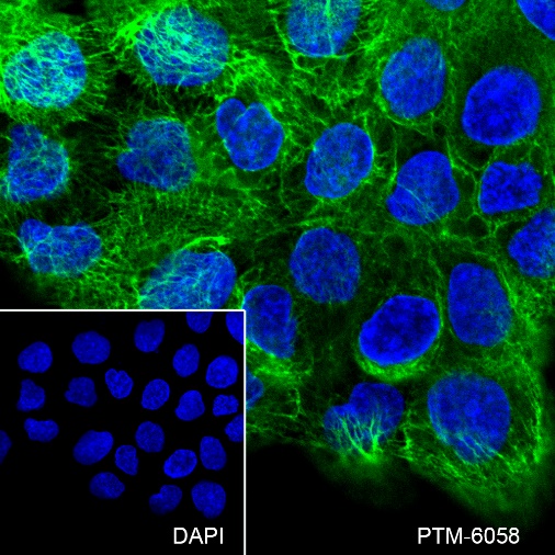 Anti-Keratin 8 Rabbit mAb